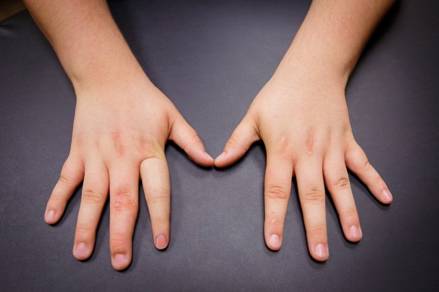 Average Finger Length